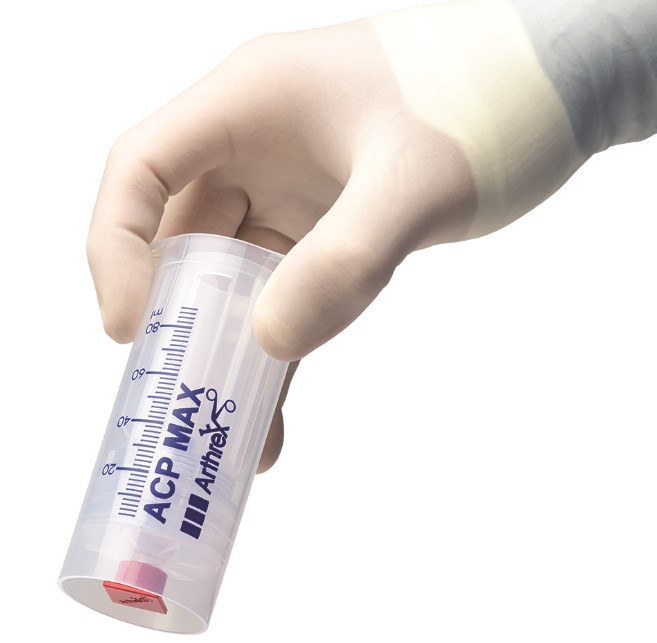 Strzykawki do osocza bogatopłytkowego w dermatologii ARTHREX ACP Max