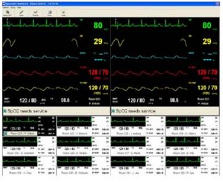 Systemy centralnego monitorowania – centrale pielęgniarskie SPACELABS Elance