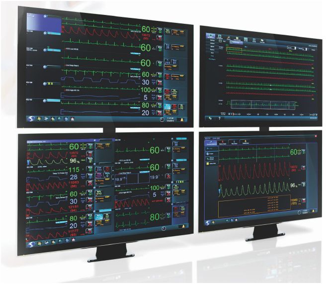 Systemy centralnego monitorowania – centrale pielęgniarskie SPACELABS Xhibit