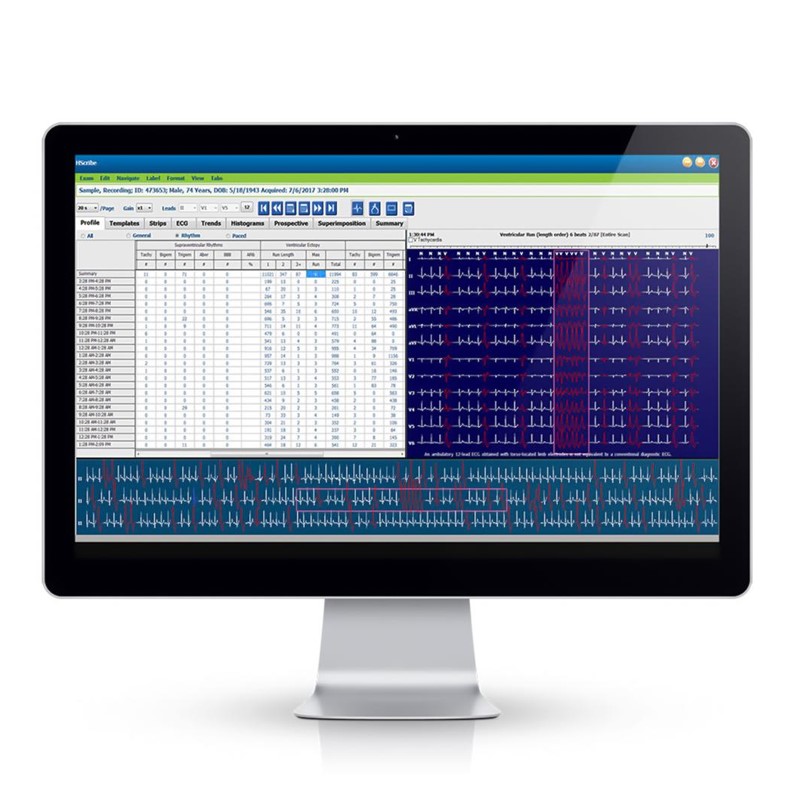 Systemy holterowskie EKG Mortara H-Scribe