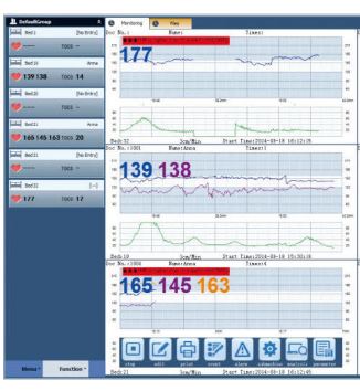 Systemy monitoringu położniczego KTG Sunray Medical Apparatus Co., Ltd SRF-618S