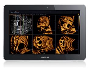 Tablety medyczne Samsung Medison Samsung Galaxy Tab