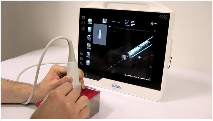 Ultrasonografy kieszonkowe ręczne (USG) eZono eZono 4000
