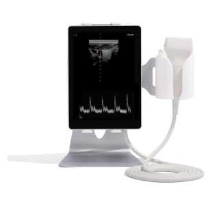 Ultrasonografy kieszonkowe ręczne (USG) Sonoscanner U-lite
