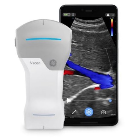 Ultrasonografy kieszonkowe ręczne (USG) GE Healthcare Vscan Air
