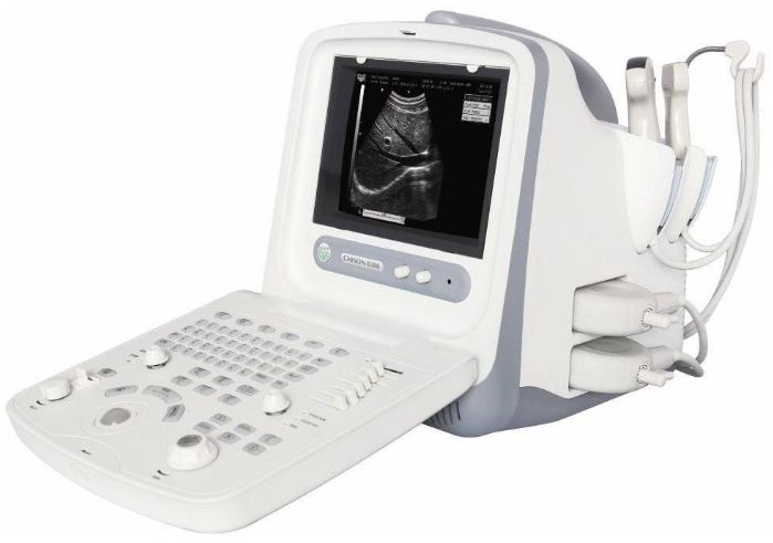 Ultrasonografy mobilne przyłóżkowe CHISON 8300