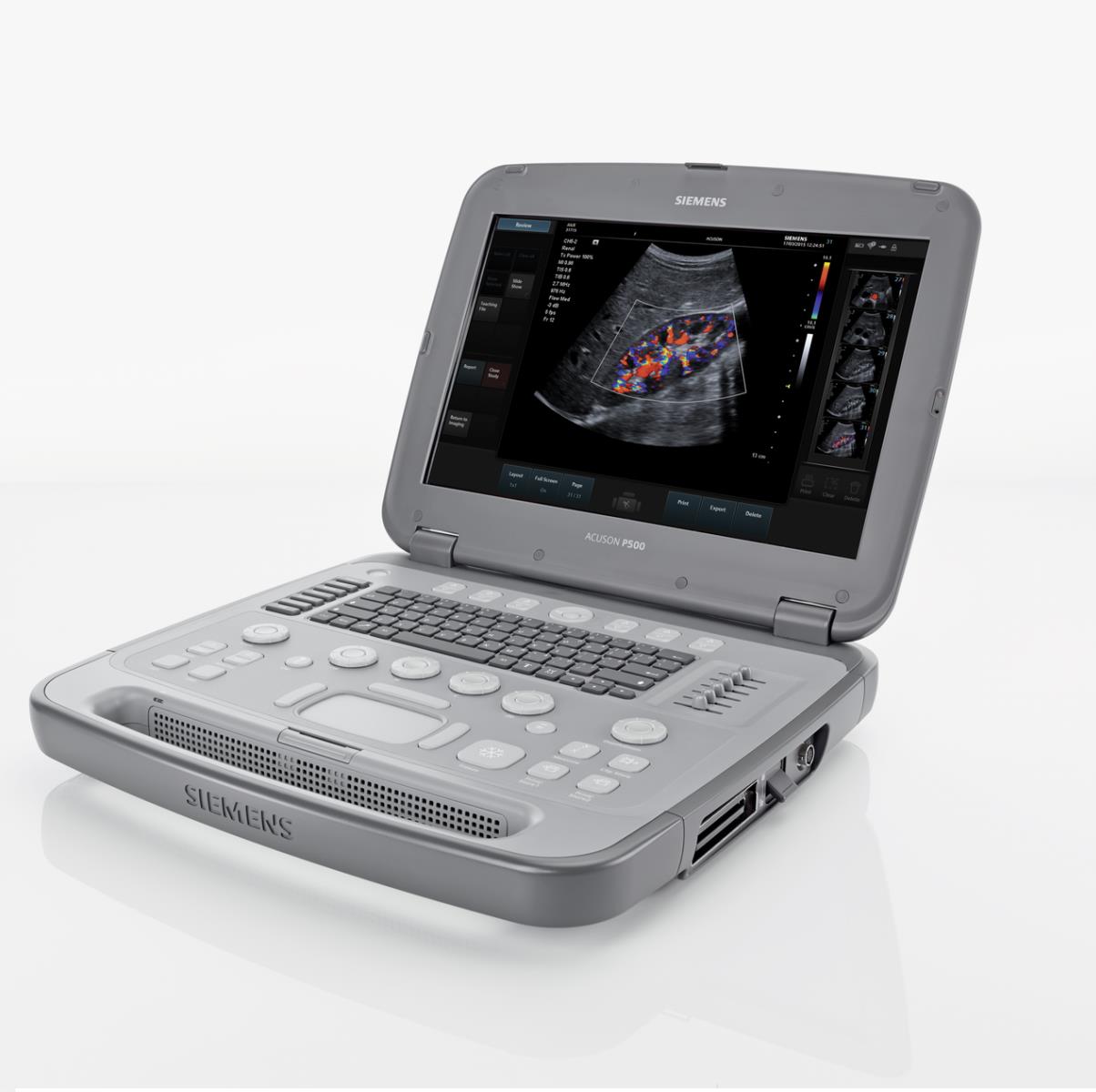 Ultrasonografy mobilne przyłóżkowe Siemens Acuson P500