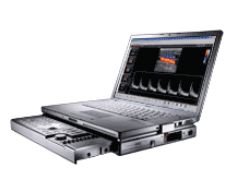 Ultrasonografy mobilne przyłóżkowe ALOKA Aloka Terason t3000