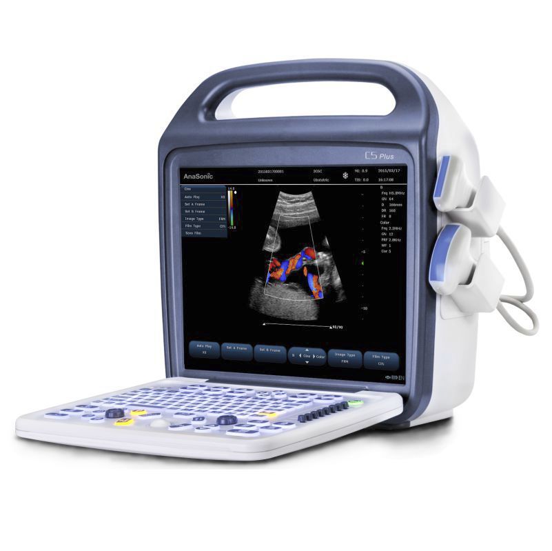 Ultrasonografy mobilne przyłóżkowe Anasonic C5Plus