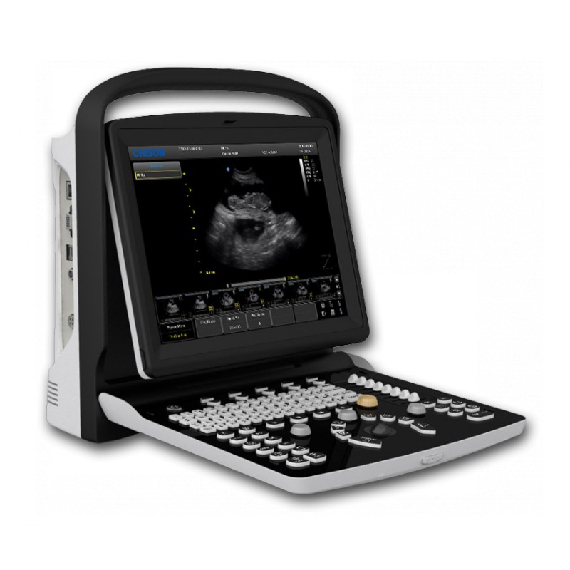 Ultrasonografy mobilne przyłóżkowe CHISON ECO 3