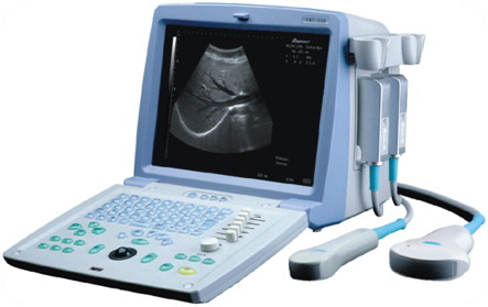 Ultrasonografy mobilne przyłóżkowe EMP EMP-830