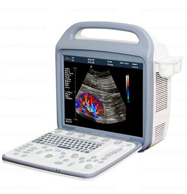 Ultrasonografy mobilne przyłóżkowe United Imaging Healthcare iuStar 100