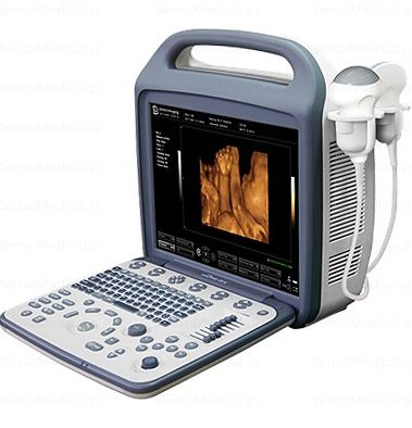 Ultrasonografy mobilne przyłóżkowe United Imaging Healthcare iuStar 160