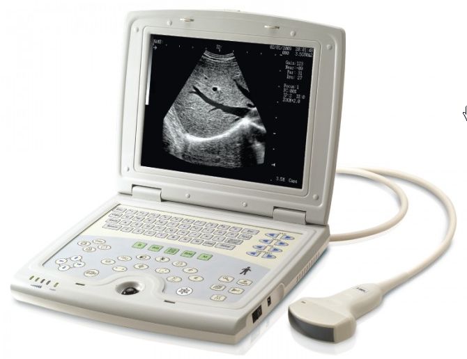 Ultrasonografy mobilne przyłóżkowe KAI XIN KX5000