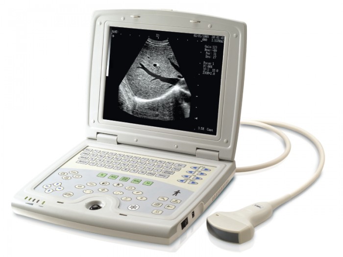 Ultrasonografy mobilne przyłóżkowe KAI XIN KX5100