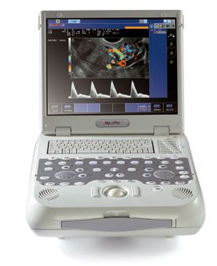Ultrasonografy mobilne przyłóżkowe ESAOTE MyLab Five