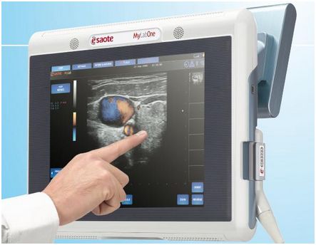 Ultrasonografy mobilne przyłóżkowe ESAOTE MyLab One