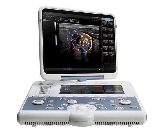 Ultrasonografy mobilne przyłóżkowe ESAOTE MyLab Six