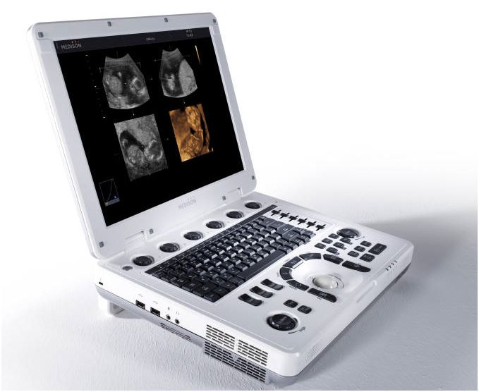 Ultrasonografy mobilne przyłóżkowe Samsung MySono U5