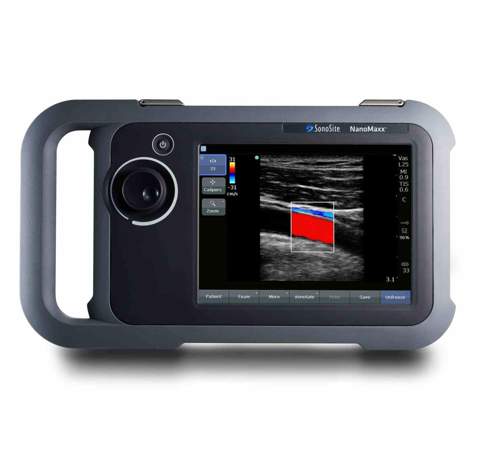Ultrasonografy mobilne przyłóżkowe SonoSite NanoMaxx