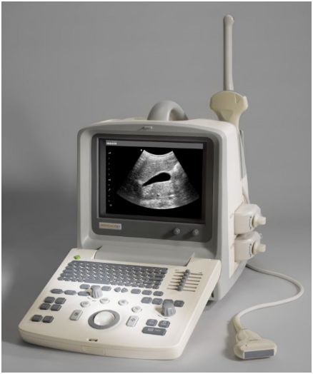 Ultrasonografy mobilne przyłóżkowe Samsung SonoAce X1