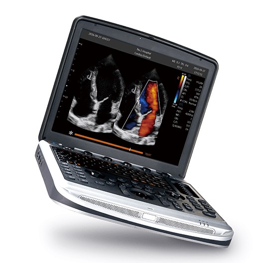 Ultrasonografy mobilne przyłóżkowe CHISON Sonobook 8