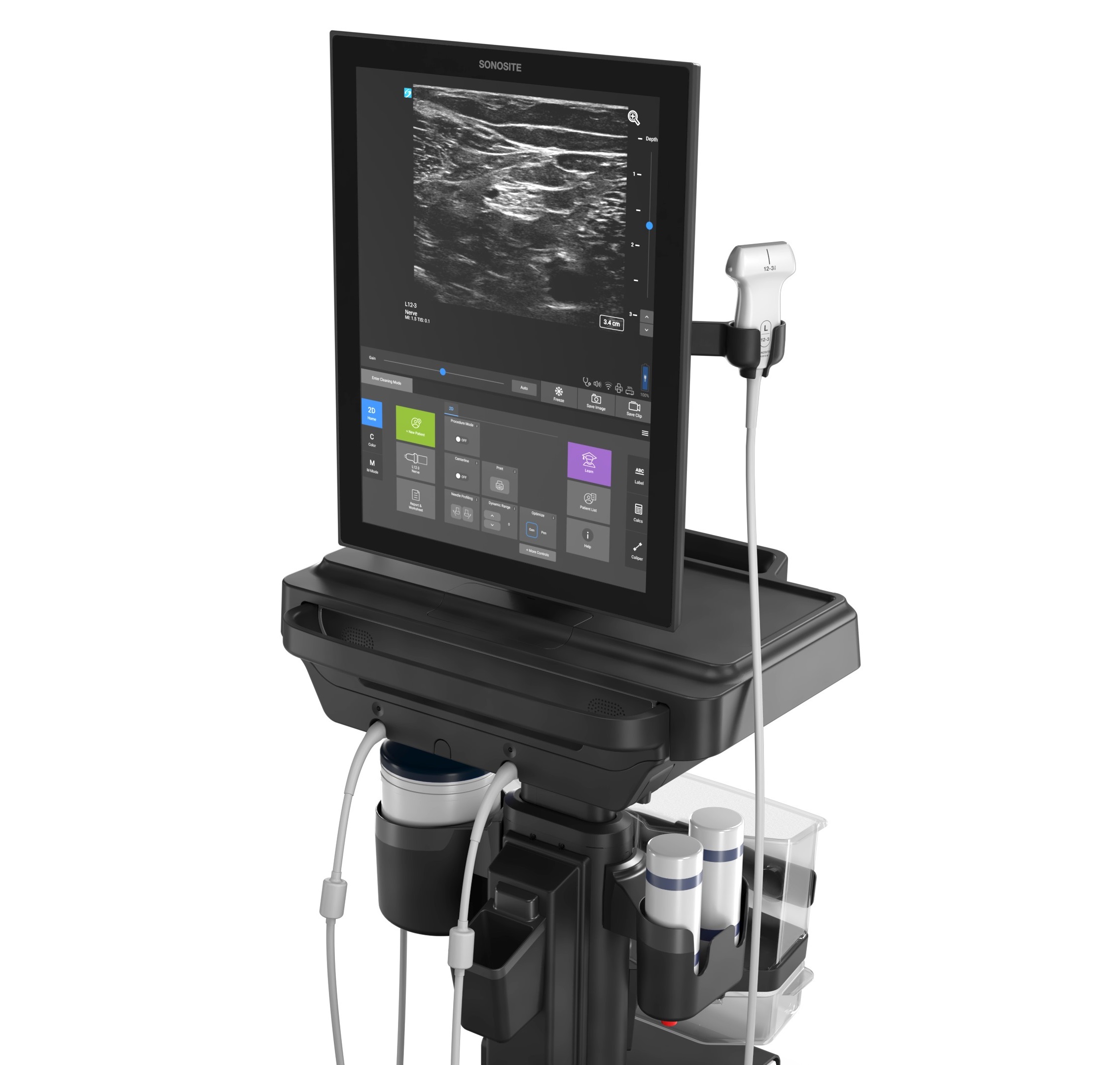 Ultrasonografy mobilne przyłóżkowe SonoSite SonoSite ST