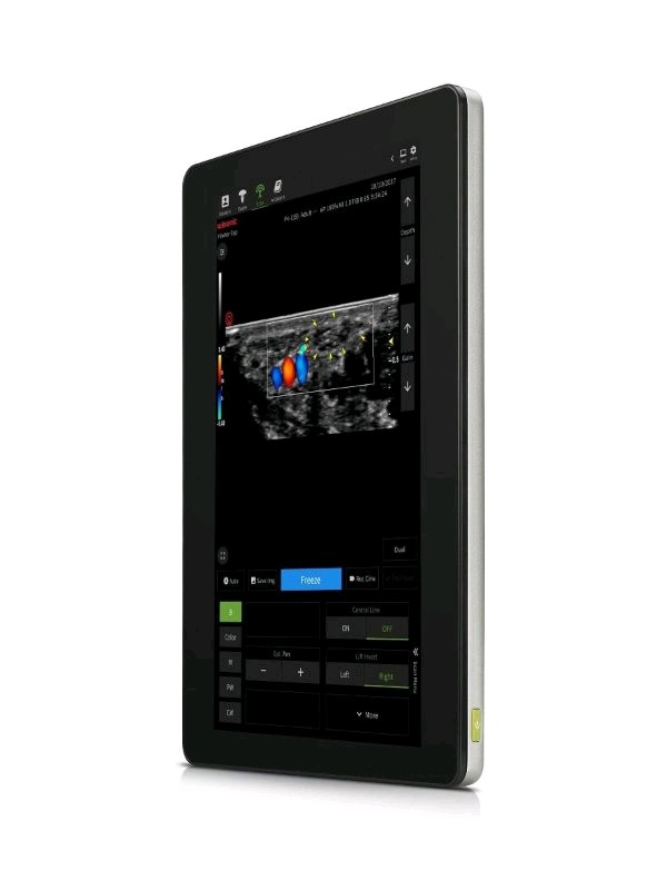 Ultrasonografy mobilne ręczne (USG) Wisonic Piloter