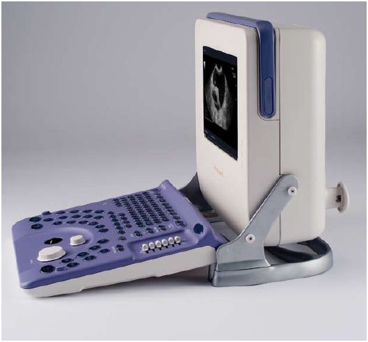 Ultrasonografy stacjonarne wielonarządowe - USG ALOKA Aloka ProSound 2