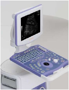 Ultrasonografy stacjonarne wielonarządowe - USG ALOKA Aloka ProSound 6