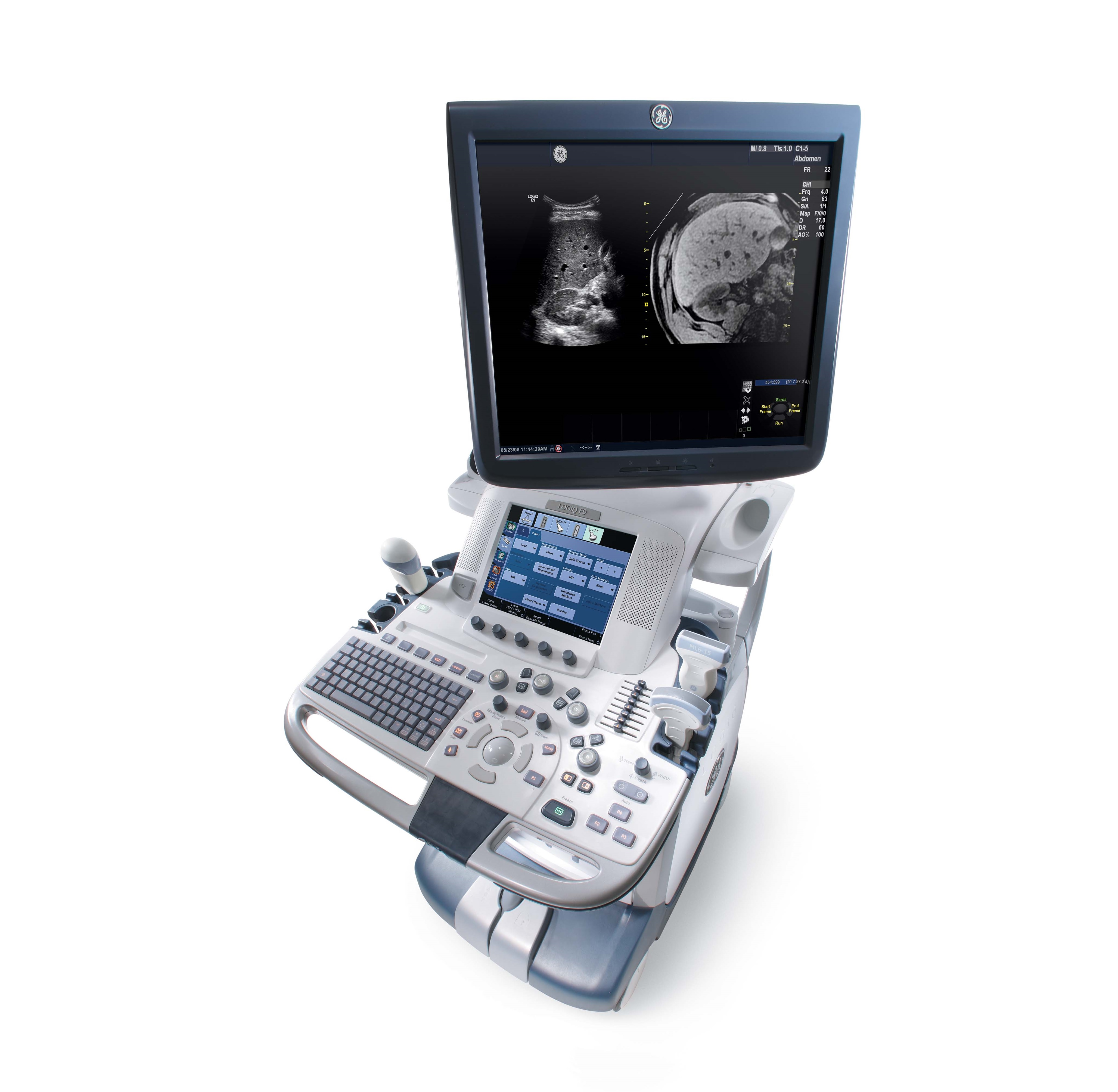 Ultrasonografy stacjonarne wielonarządowe - USG GE Healthcare LOGIQ E9