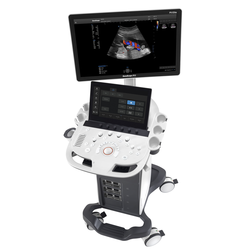 Ultrasonografy stacjonarne wielonarządowe - USG SonoScape P9 Elite