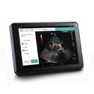 Ultrasonografy wielonarządowe - USG SonoSite iViz