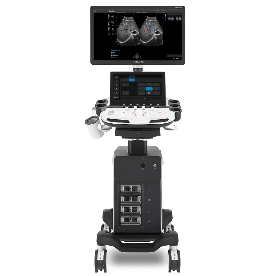 Ultrasonografy wielonarządowe - USG SonoScape P12 Elite