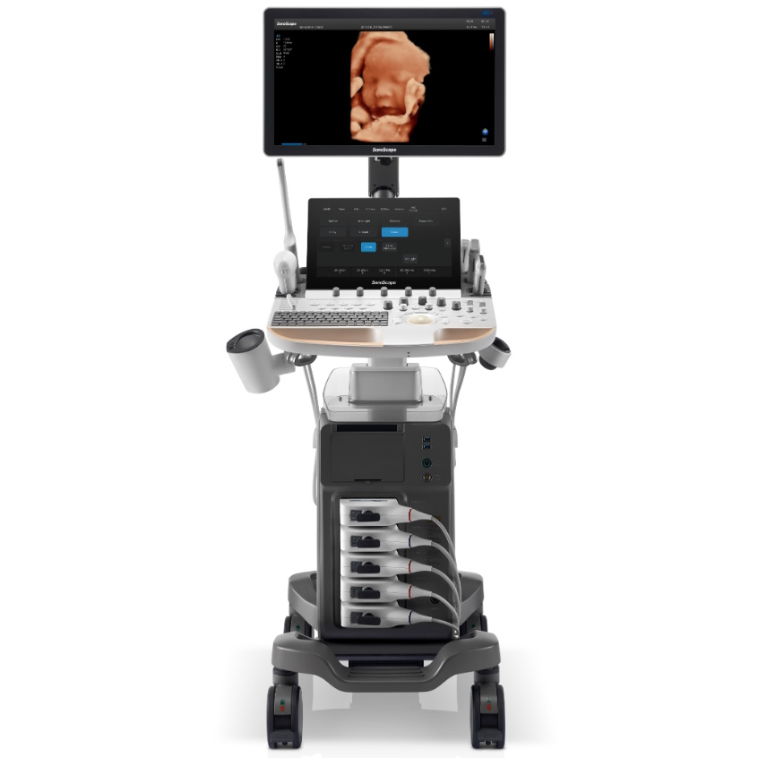 Ultrasonografy wielonarządowe - USG SonoScape P60