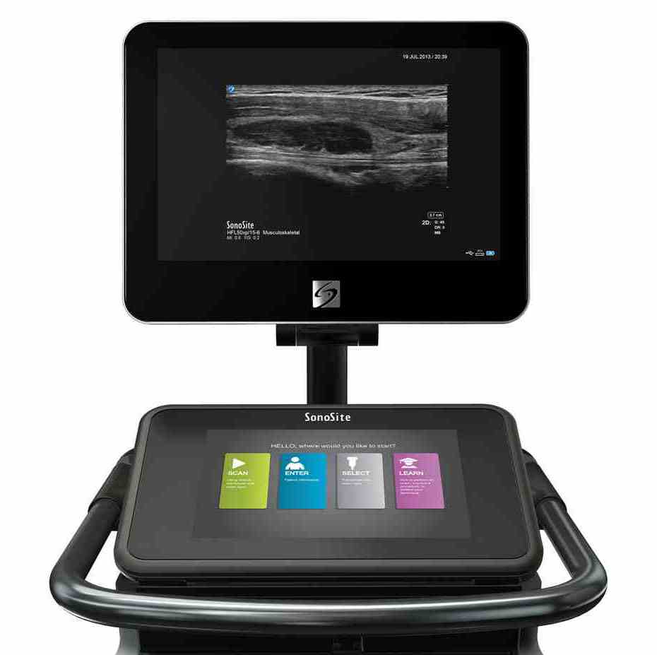 Ultrasonografy wielonarządowe - USG SonoSite X-Porte
