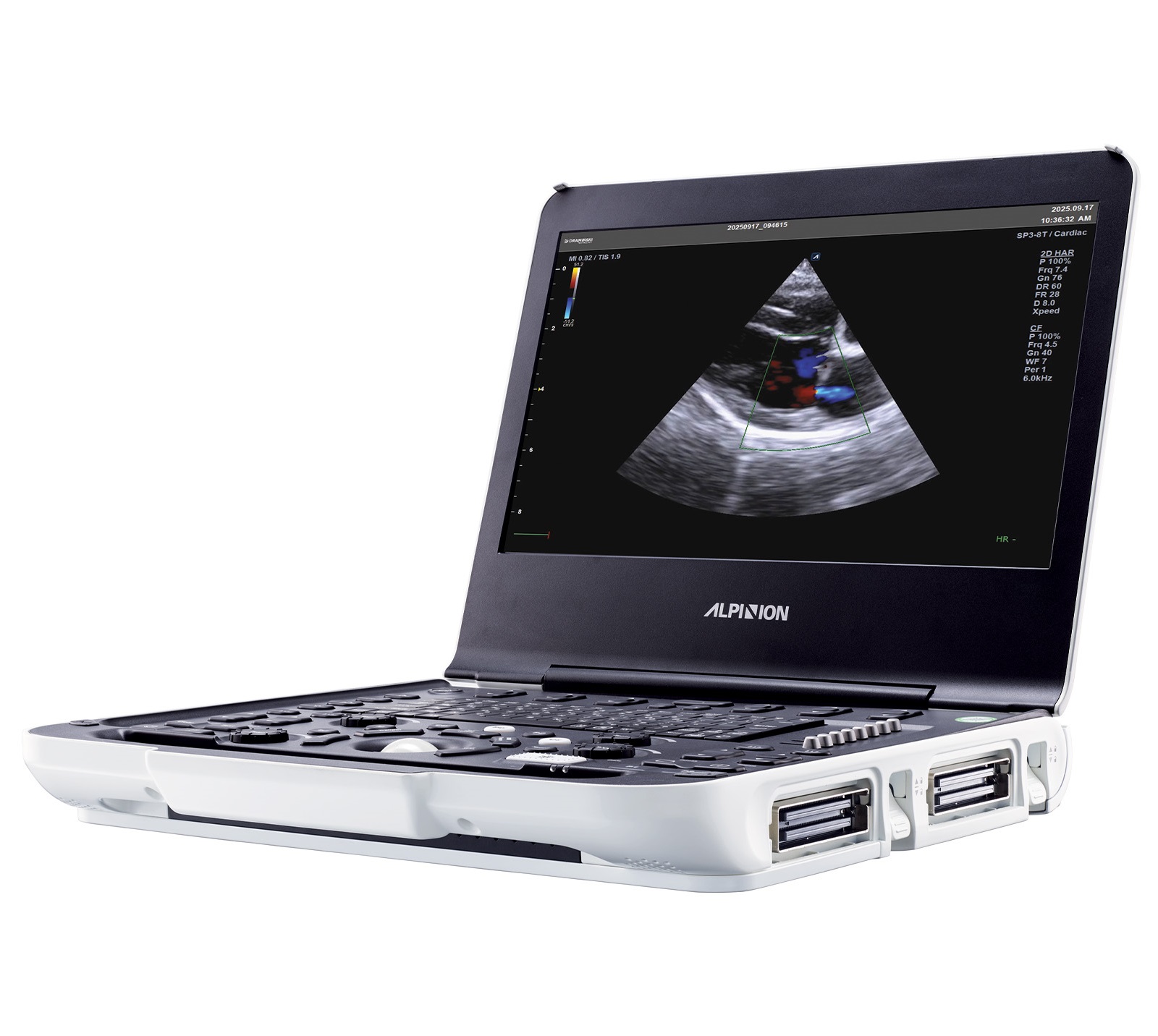 Ultrasonografy wielonarządowe weterynaryjne - USG Alpinion X-CUBE i9