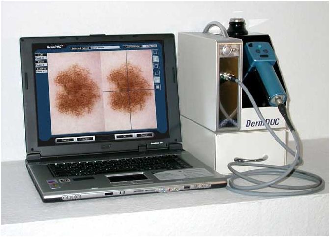 Videodermatoskopy DERMA MEDICAL DermDOC