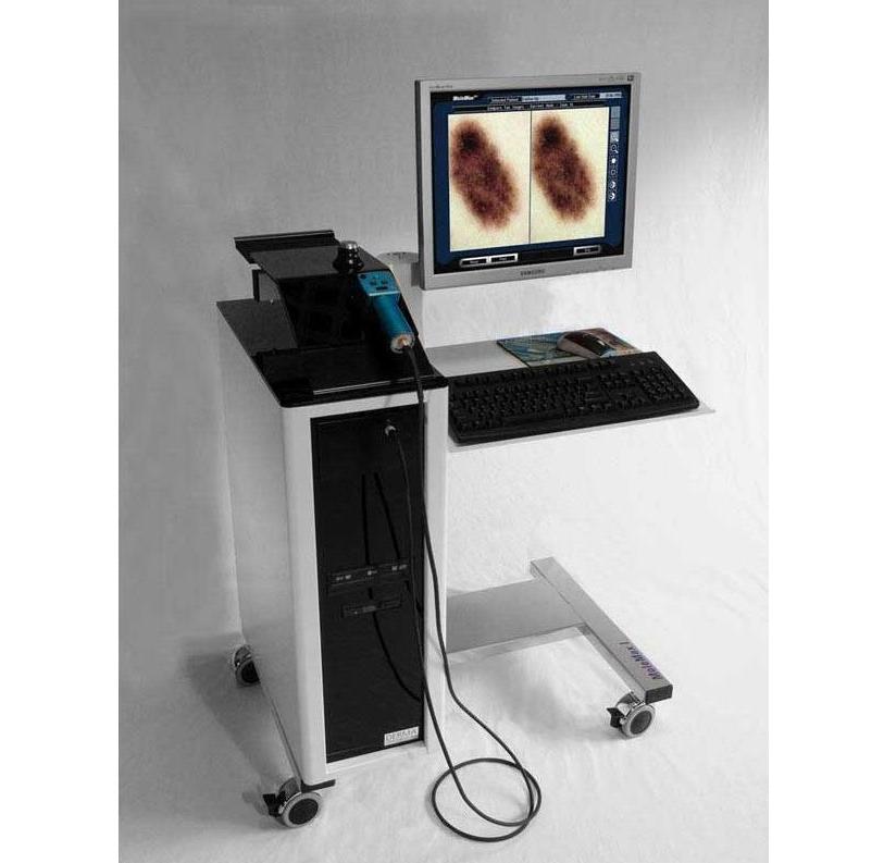 Videodermatoskopy DERMA MEDICAL MoleMax I