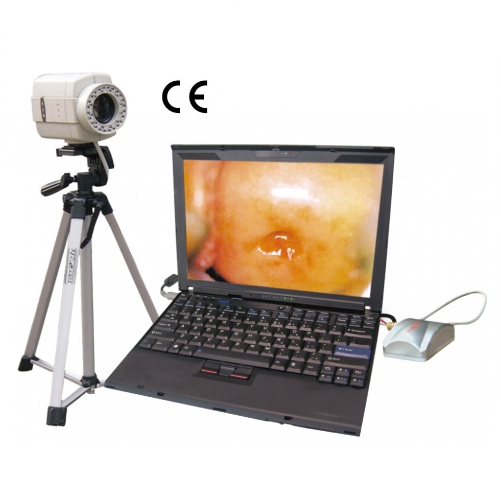 Wideokolposkopy (videokolposkopy) SONY PL-9800