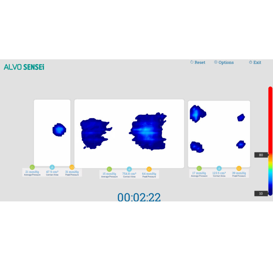 Wyposażenie stołów operacyjnych ALVO Medical SENSEi