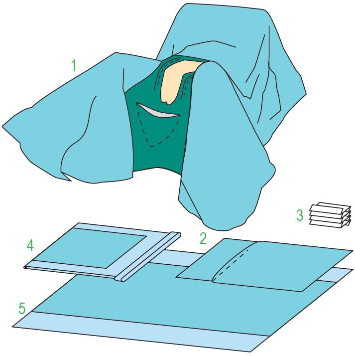 Zestawy do ginekologii – obłożenia pola operacyjnego BARRIER/MOLNLYCKE Zestaw do zabiegów ginekologicznych VI 905020