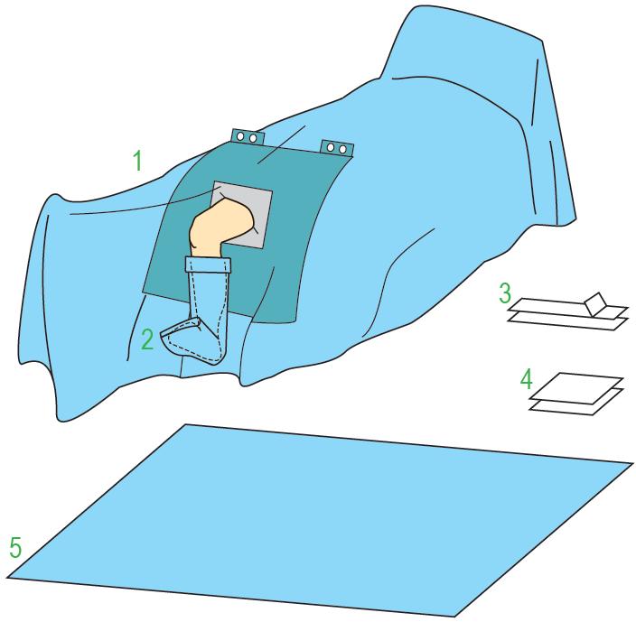 Zestawy do ortopedii – obłożenia pola operacyjnego JKT/MOLNLYCKE Zestaw do artroskopii I 380140