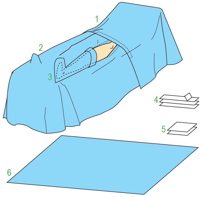 Zestawy do ortopedii – obłożenia pola operacyjnego JKT/MOLNLYCKE Zestaw do operacji stawu biodrowego V 380146