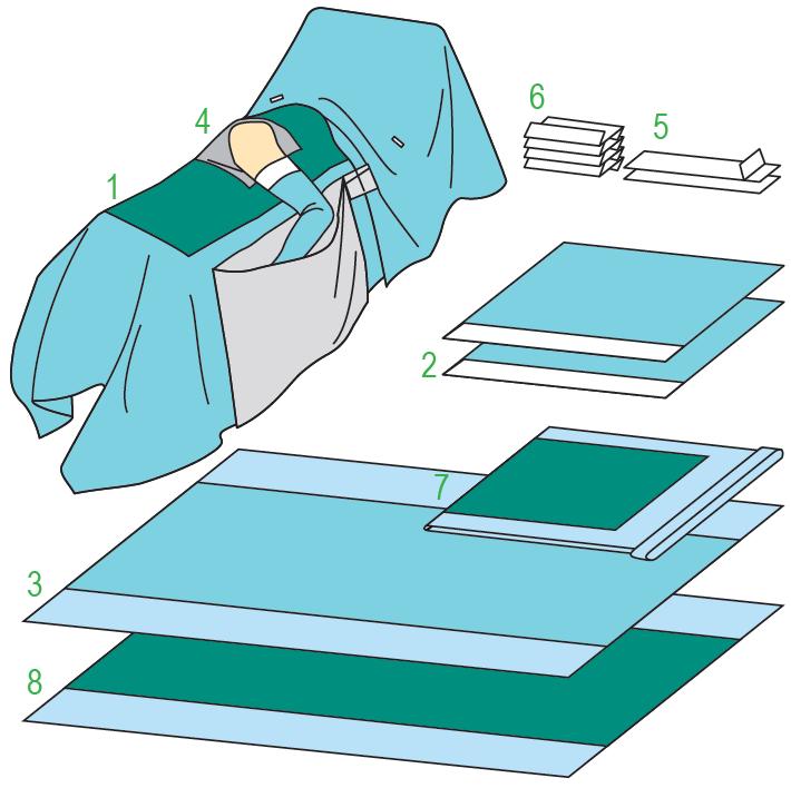 Zestawy do ortopedii – obłożenia pola operacyjnego BARRIER/MOLNLYCKE Zestaw do operacji stawu biodrowego VII 60602