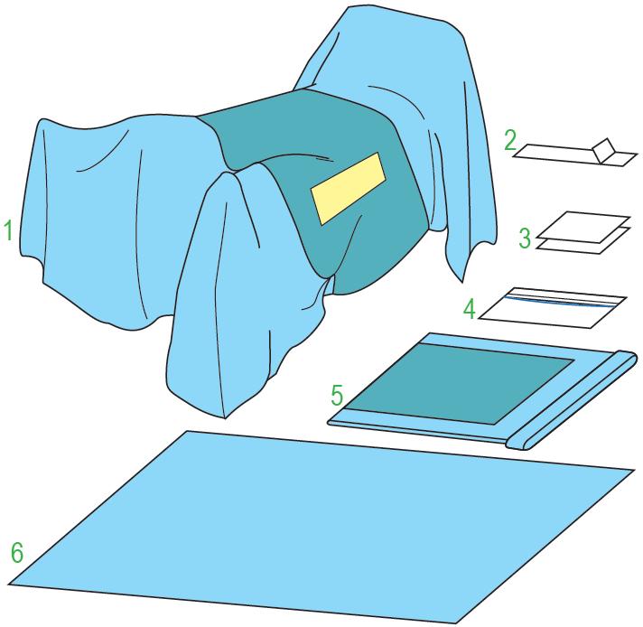 Zestawy do ortopedii – obłożenia pola operacyjnego JKT/MOLNLYCKE Zestaw do operacji stawu biodrowego VIII (DHS) 380536