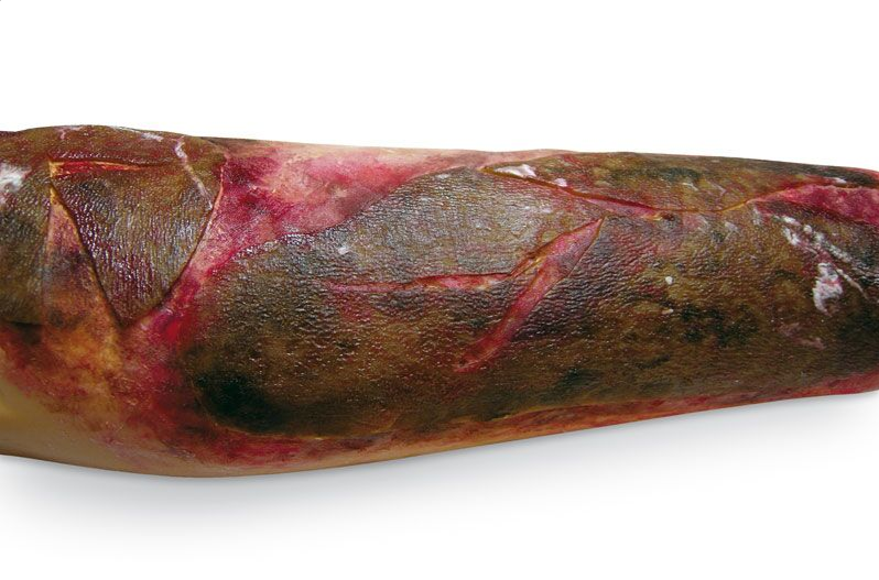 Zestawy do pozoracji ran 3B Scientific R11015