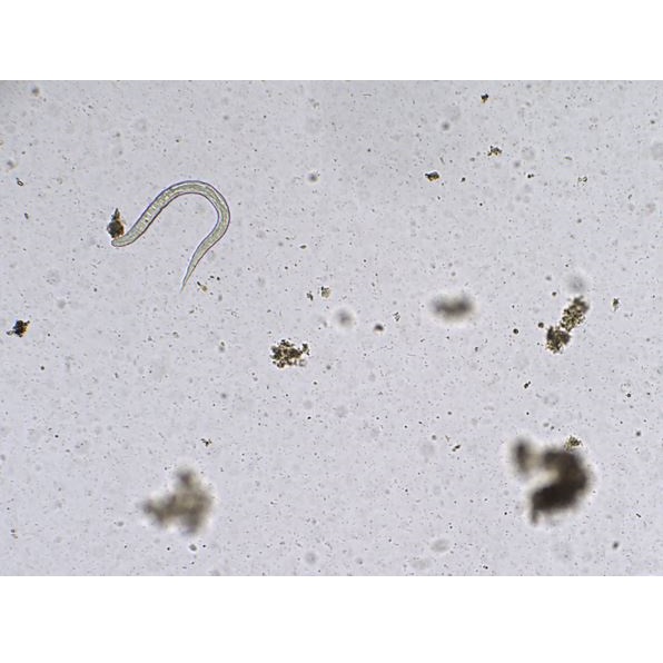 Analizatory kału KEYU KU-F40