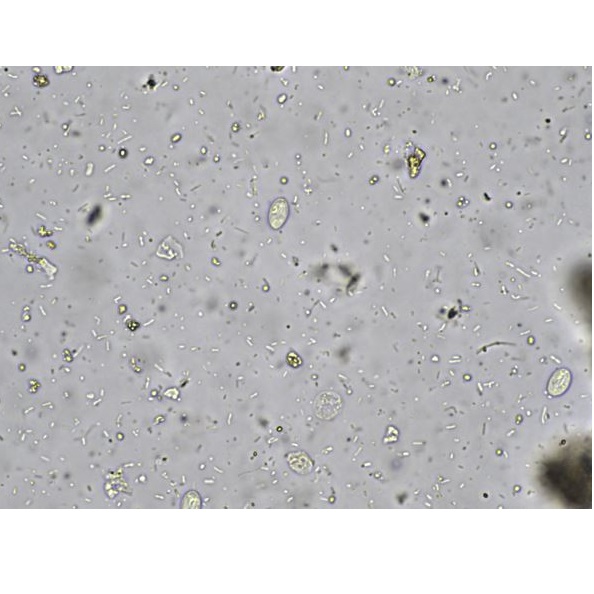 Analizatory kału KEYU KU-F40