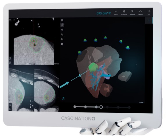  Aparaty do ablacji guzów Cascination CAS-One IR